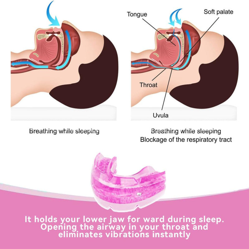 Anti-Snore Mouthpiece Screw Adjustable BPA Free With Anti bacterial Storage Case